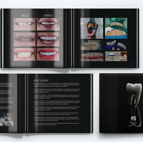 Diş Protez Laboratuvarı Broşür Tasarımı