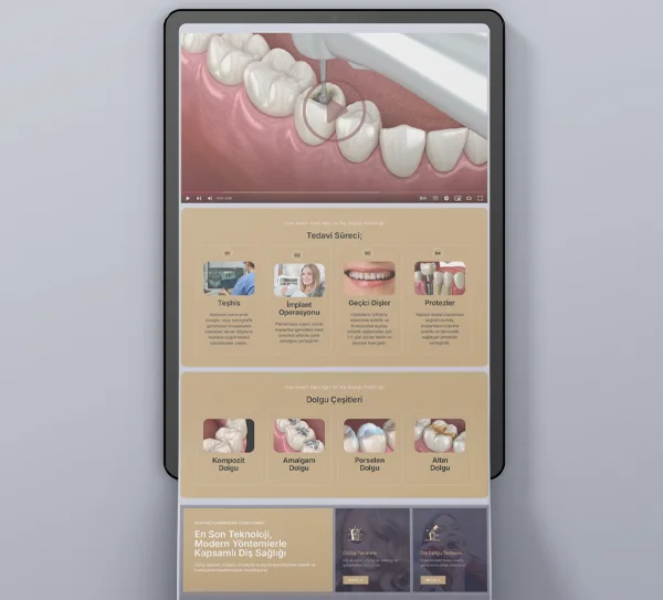 Analizdent Diş Kliniği Mobil Websitesi Tasarımı