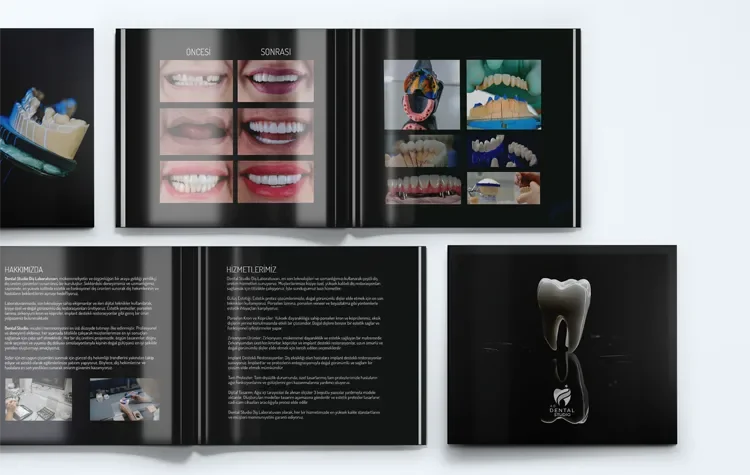 Diş Protez Laboratuvarı Katalok Tasarımı
